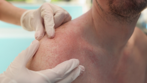 Dermatology consultation at Dr. Prratyush More clinic