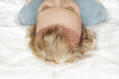 Dr. Prratyush More with Dr. Alex Ginzburg Israel hair transplant training