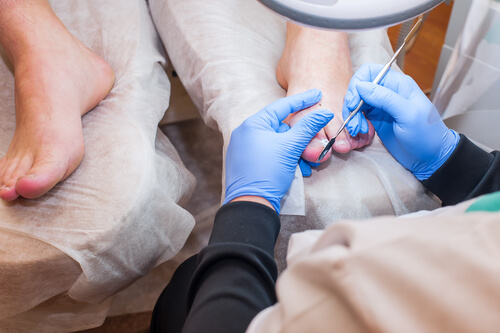 Nail surgery nail disorders Dr. Prratyush More Thane