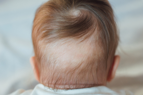 Paediatric trichology consultation Dr. Prratyush More Thane