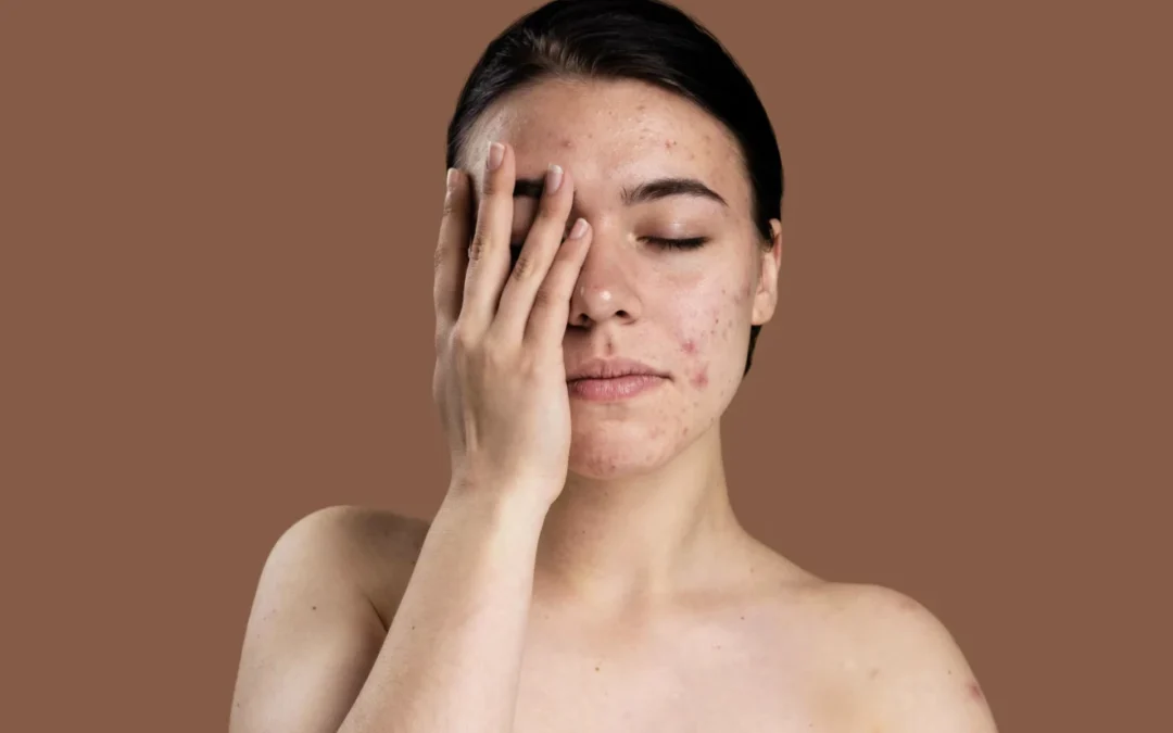 Pigmentation: Why It Happens and How It’s Actually Treated