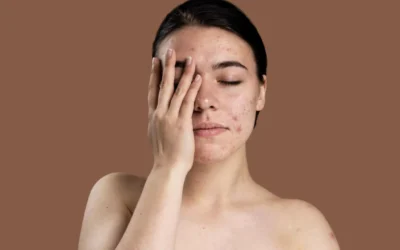 Pigmentation: Why It Happens and How It’s Actually Treated