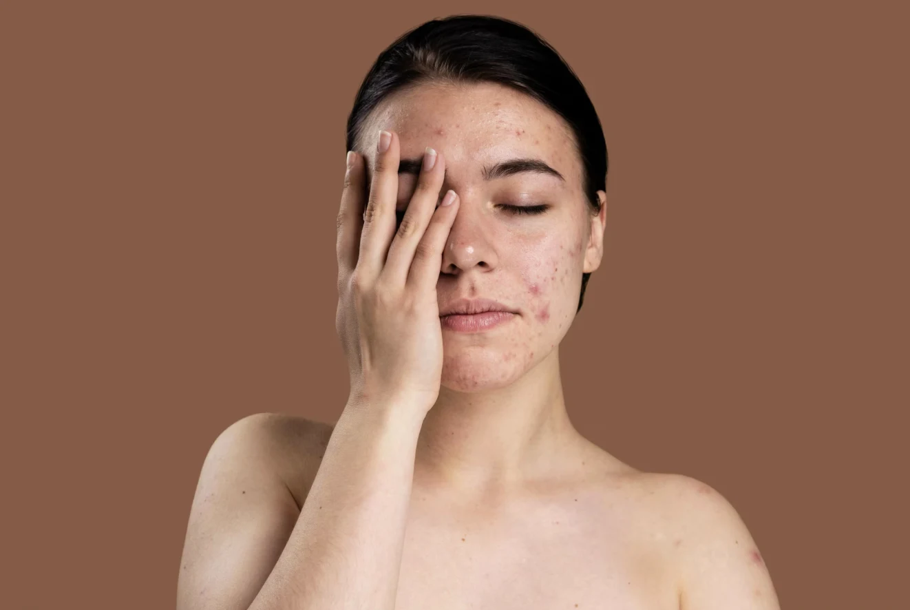 Pigmentation: Why It Happens and How It’s Actually Treated