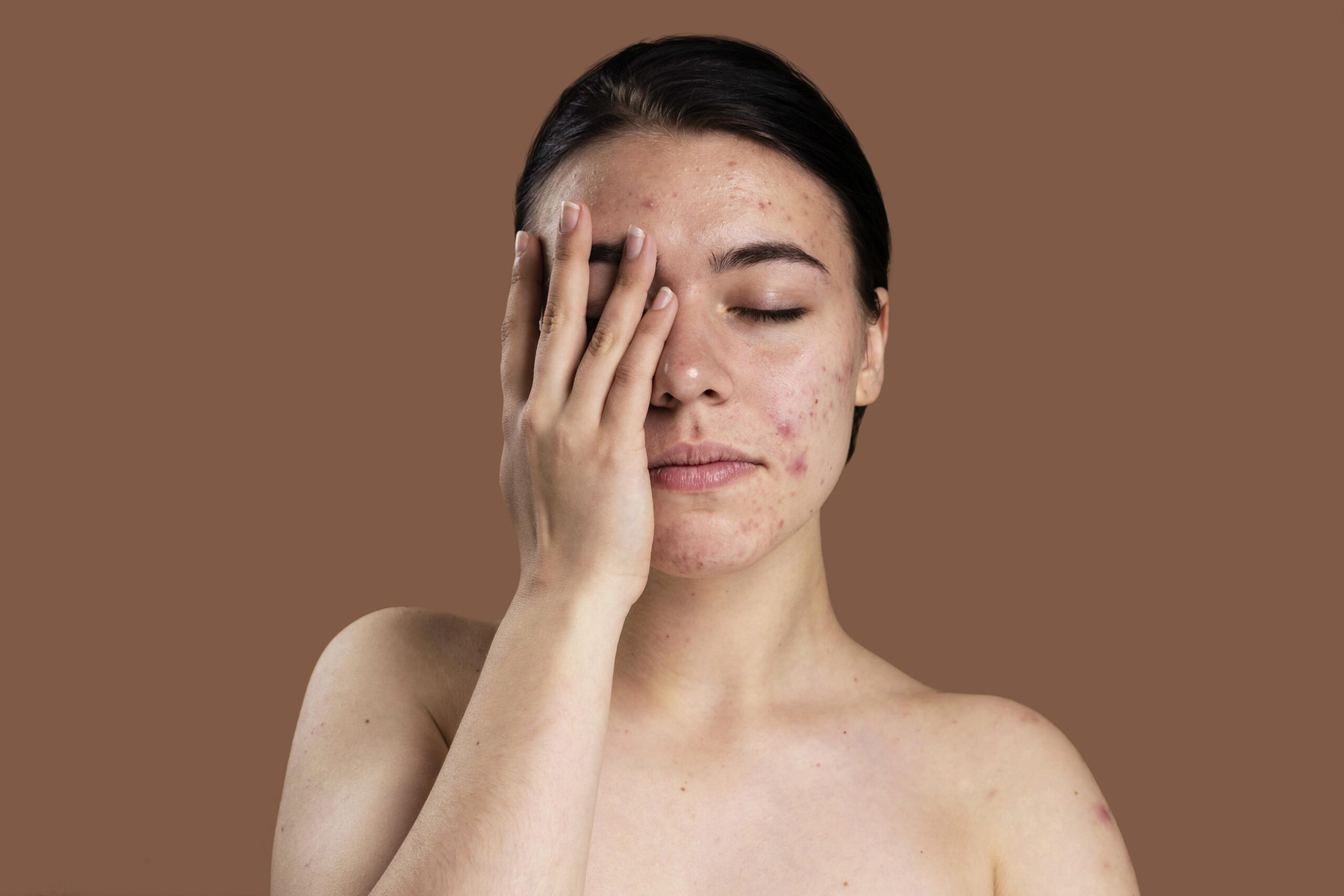 Pigmentation Disorders: Causes, Types & How Dermatologists Treat Them